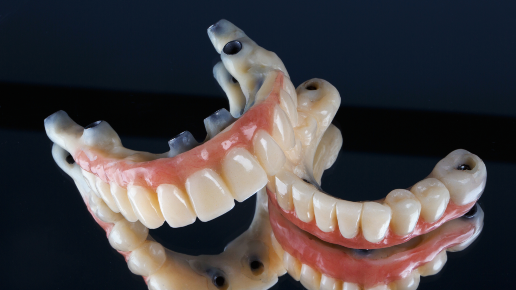 How Many Days Are Needed for Dental Implants in India? A Complete Timeline Guide homepage slider for clothing brand website sale (blog banner) (32)