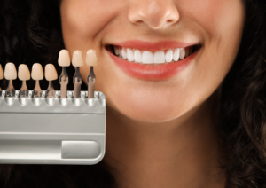 How to Care For Veneers After Treatment: 15 Powerful Tips for a Long-Lasting Smile